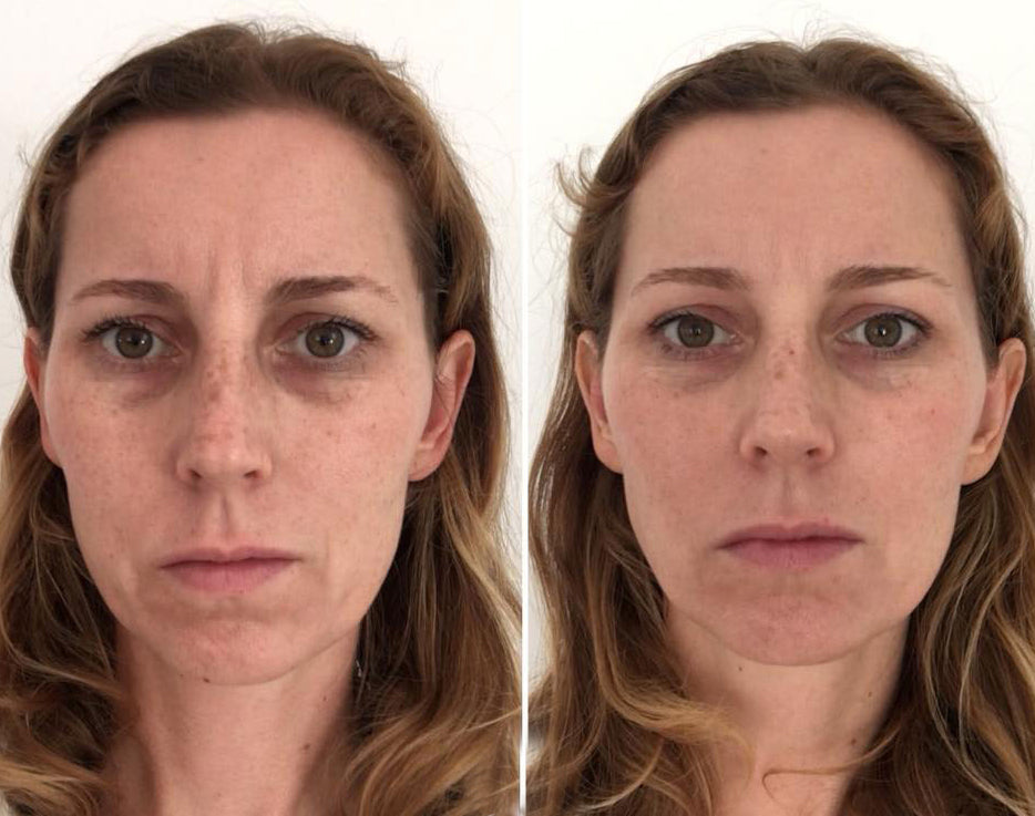 Face Yoga Kuur - Verstevig en Verjong Je Gezicht!