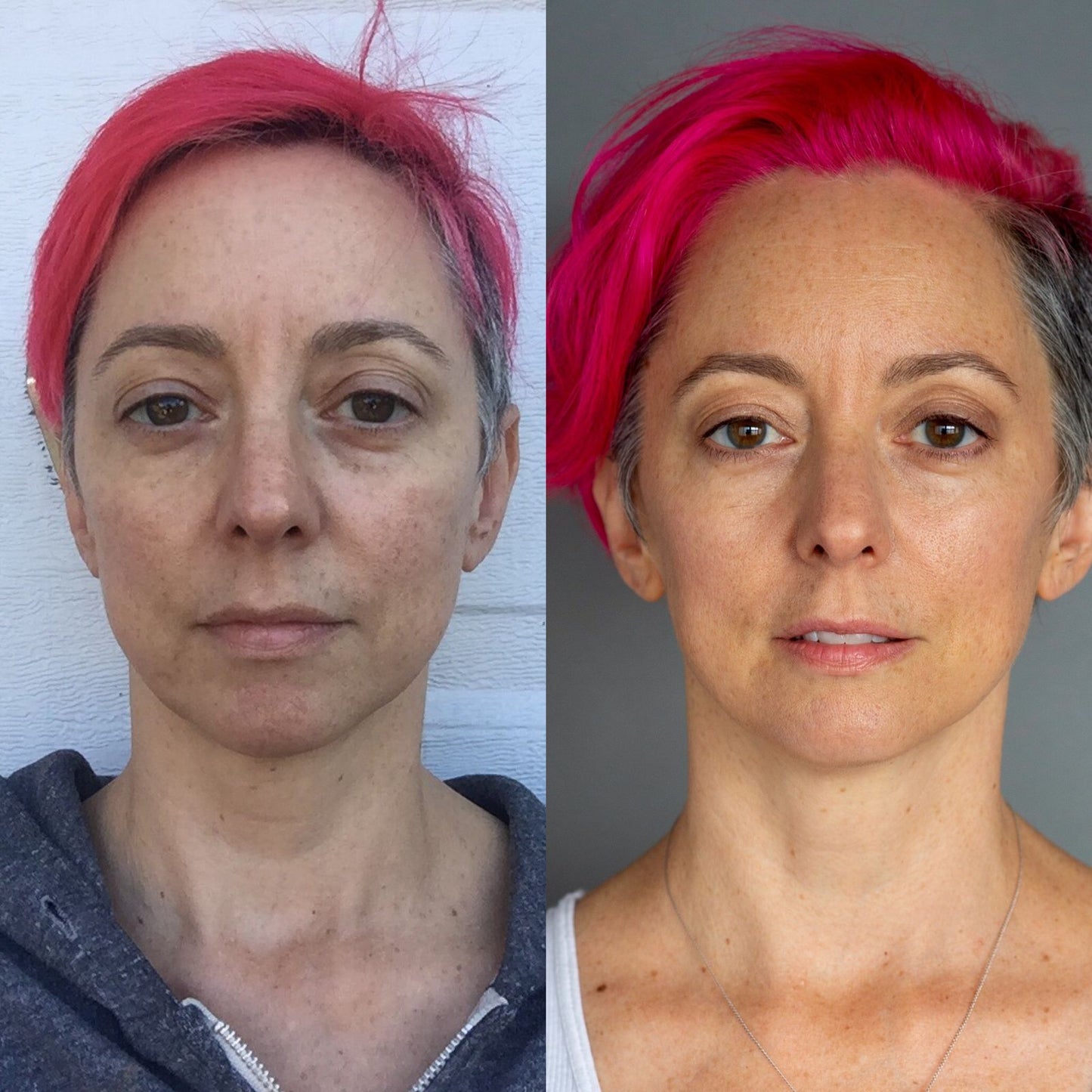 Face Yoga Kuur - Verstevig en Verjong Je Gezicht!